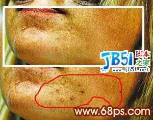 ‘Photoshop把满脸痘痘变光滑细嫩的方法‘