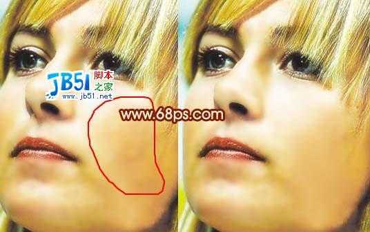 ‘Photoshop把满脸痘痘变光滑细嫩的方法‘