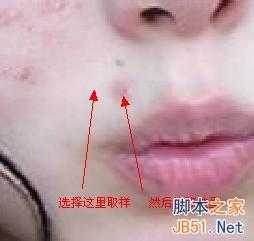 ‘PS如何快速去除面部青春痘‘