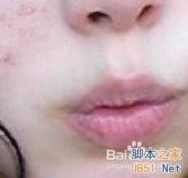 ‘PS如何快速去除面部青春痘‘