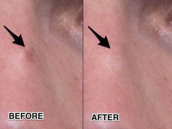 ‘Photoshop将帅哥照片转为夸张的油画漫画效果‘