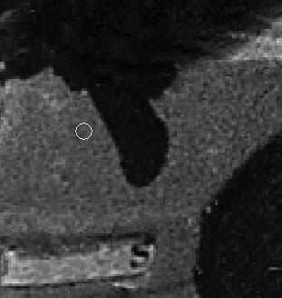 ‘PS快速修复被撕坏的旧照片‘