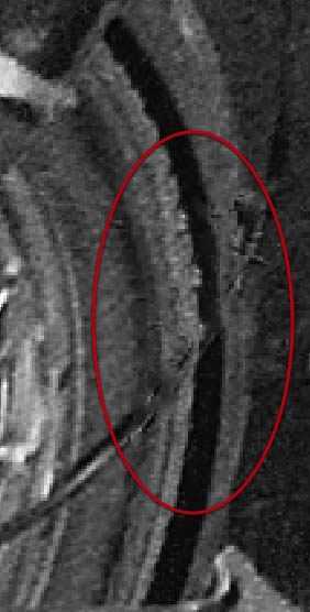 ‘PS快速修复被撕坏的旧照片‘