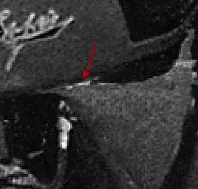 ‘PS快速修复被撕坏的旧照片‘