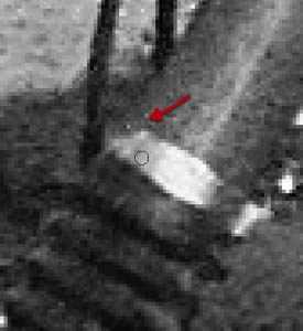 ‘PS快速修复被撕坏的旧照片‘