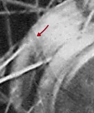 ‘PS快速修复被撕坏的旧照片‘