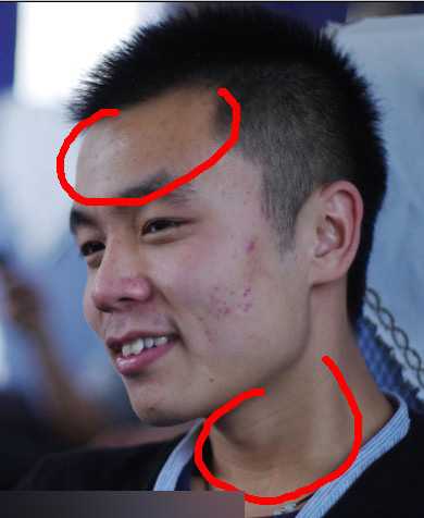 ‘PS给人物照片磨皮祛痘教程‘