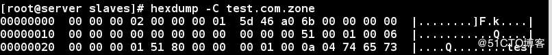 linux的DNS之主从同步配置