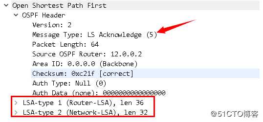 假装网络工程师2——初识OSPF